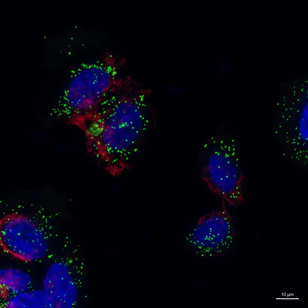 HeLa cells stained with lipid-droplet dye